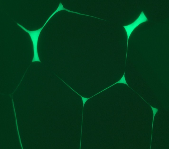 Fluorescence Microscopy